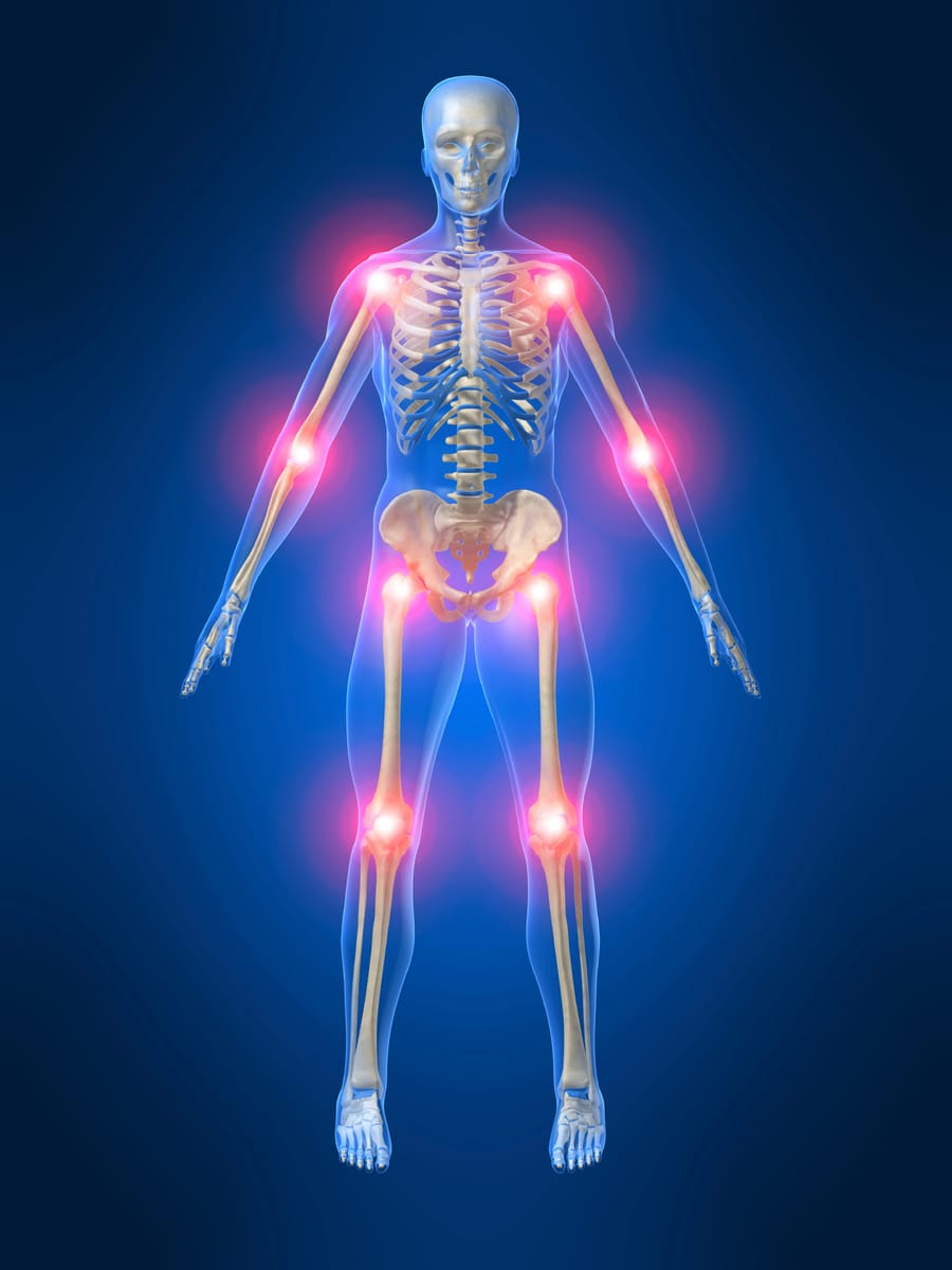Skeleton Body Joint Pain Glow